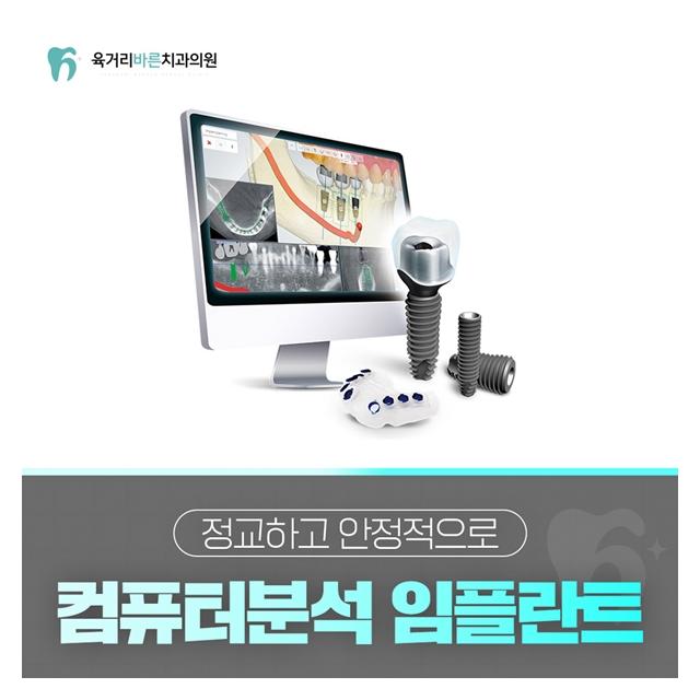 컴퓨터분석 임플란트 정밀한 진단을 통해 정직한 진료계획 수립